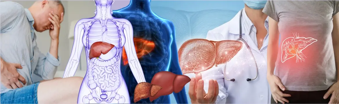 Liver Cirrhosis Management