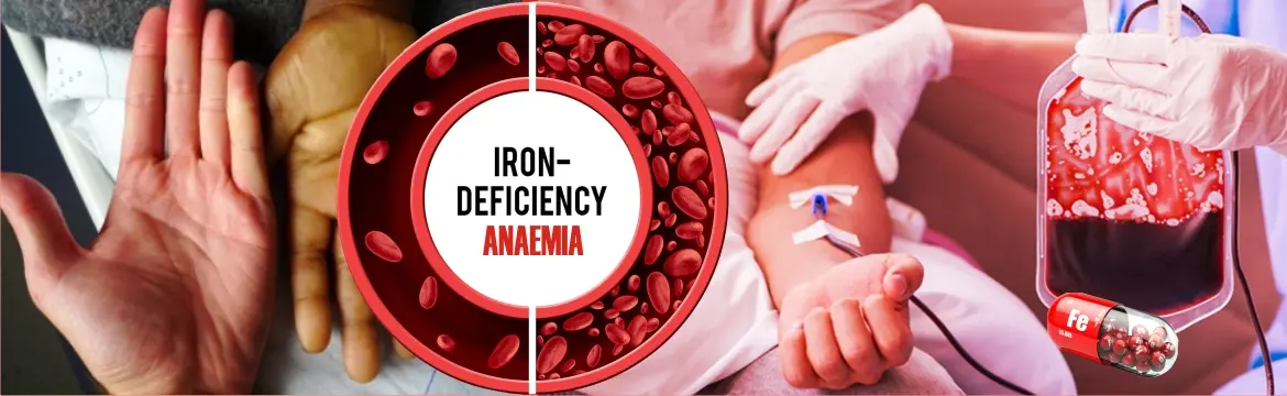 Anaemia Management