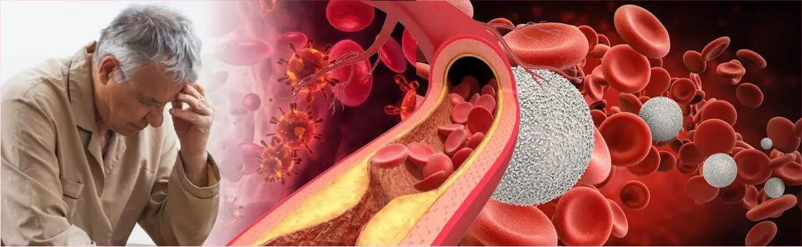 Leukemia Management