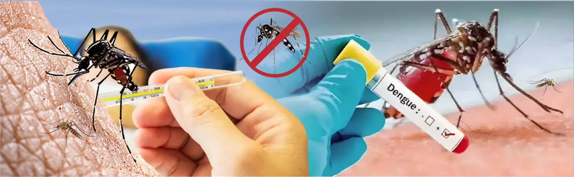 Dengue Fever Management